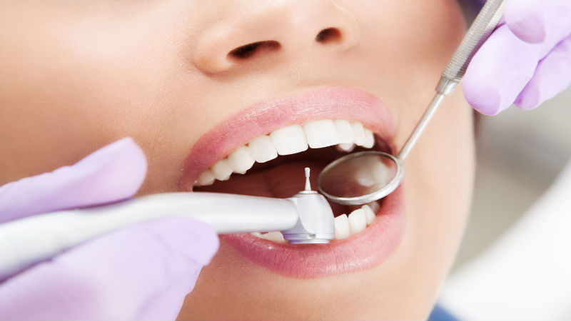 Find Out Important Info About Dental Fillings In Midwest City, OK