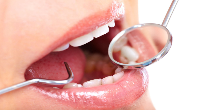 Pain-Free Dentistry In Sydney: Importance