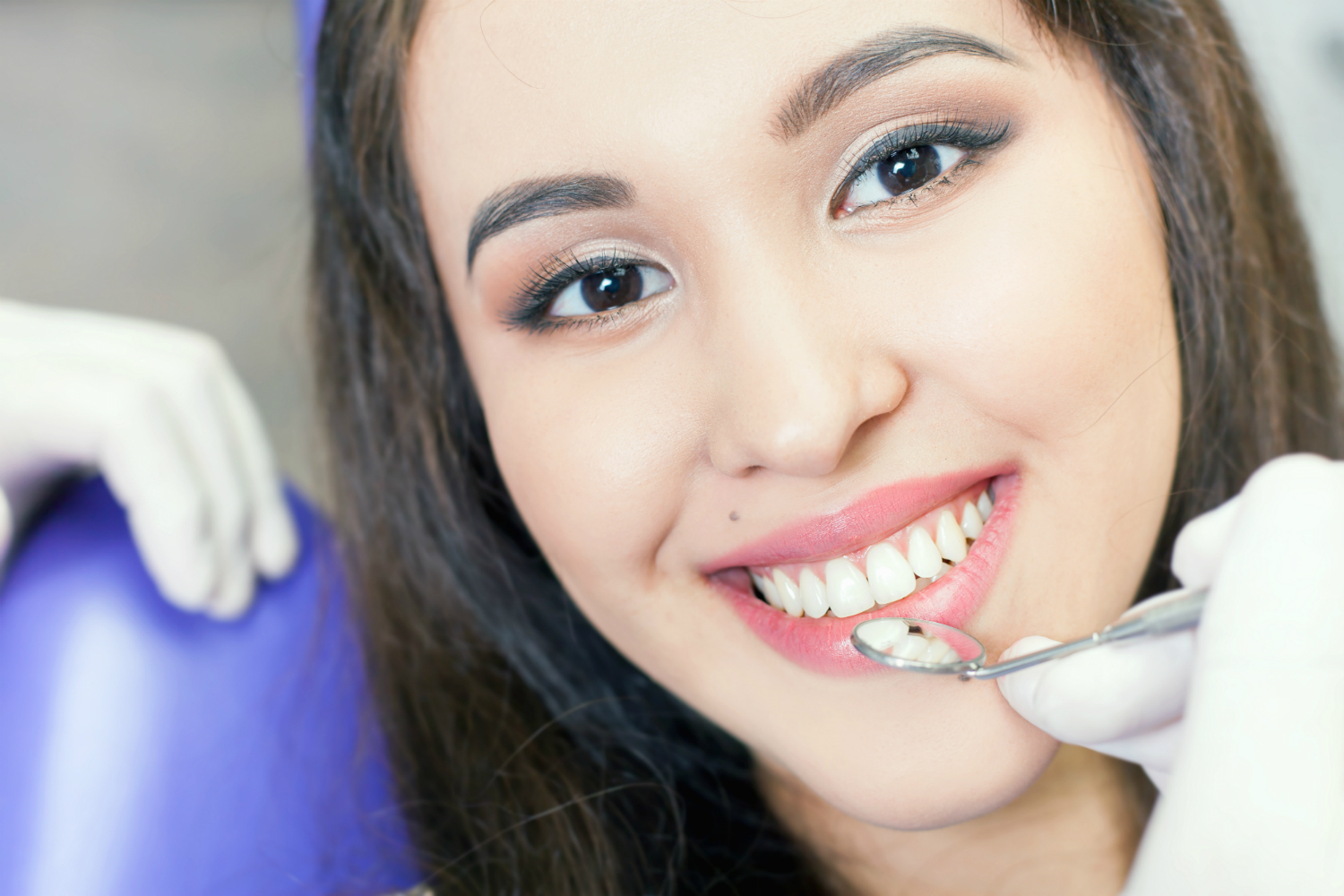 Cosmetic Dentist Castle Hill: Advantages