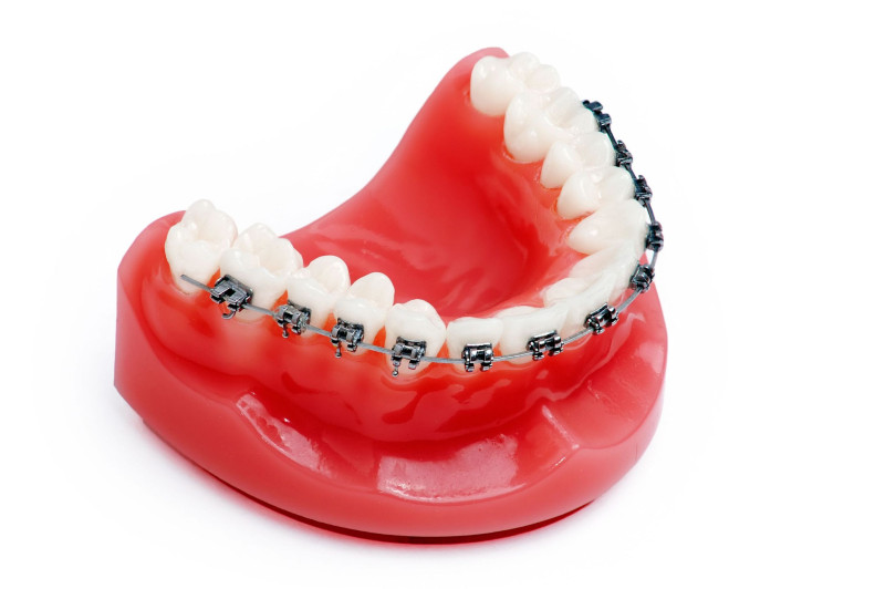 3 Reasons to Ask Your Dentist About Invisalign in Philadelphia