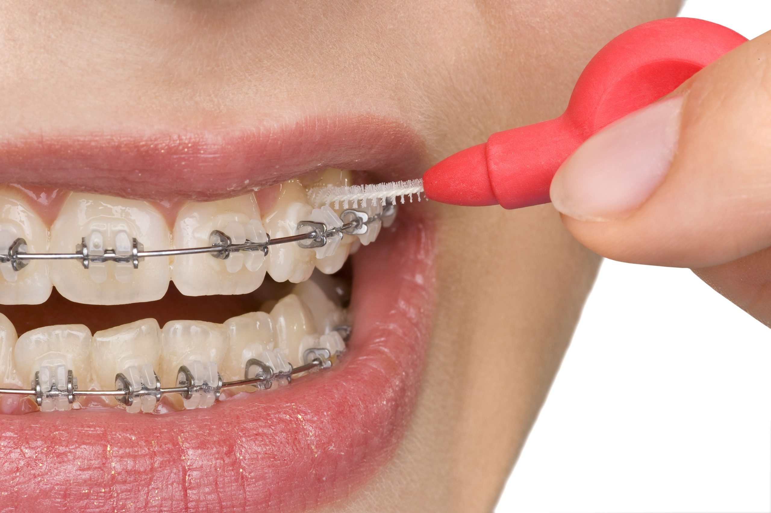 The Comprehensive Benefits of Working with an Orthodontist in Oxnard, CA